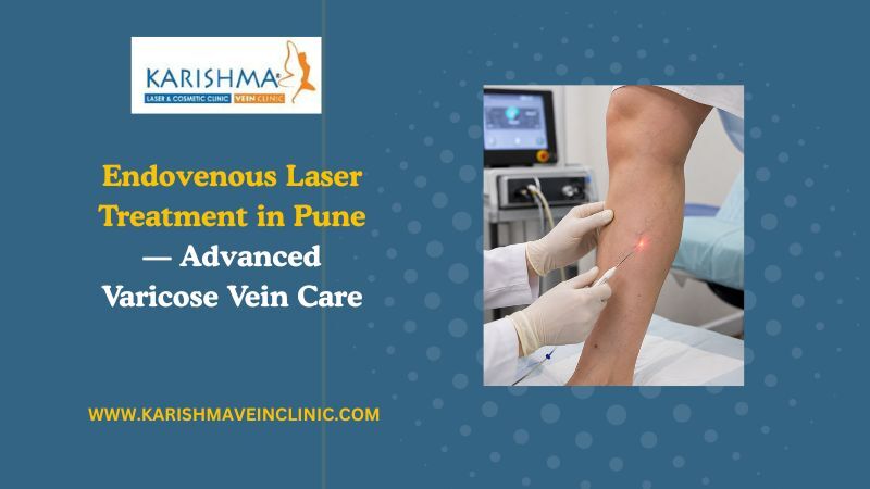Pune, Health, Endovenous Laser Treatment In Pune