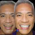 Teeth Whitening Cambridge &ndash; Professional Teeth Whitening For A Brighter Smile