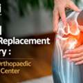 Choose Expert Total Knee Arthroplasty Care With Dr. Divyesh Bukalsaria