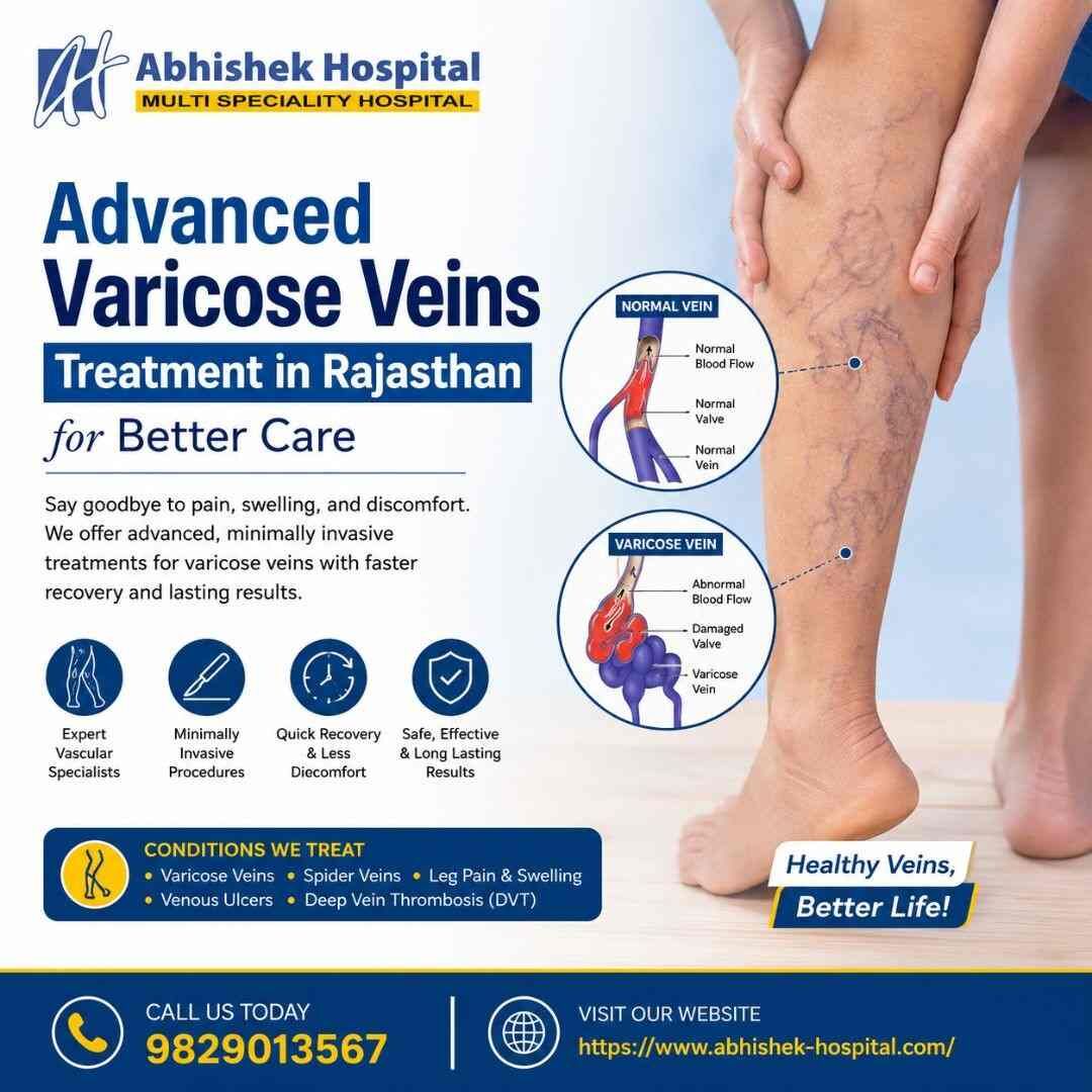 Jaipur, Health, Advanced Varicose Veins Treatment In Rajasthan For Better Care