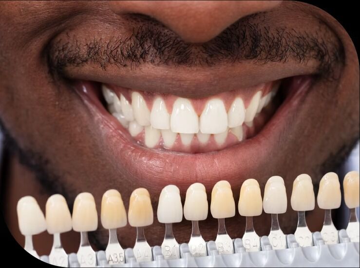 Toronto, Dental, Mh2 Dental - Queen West