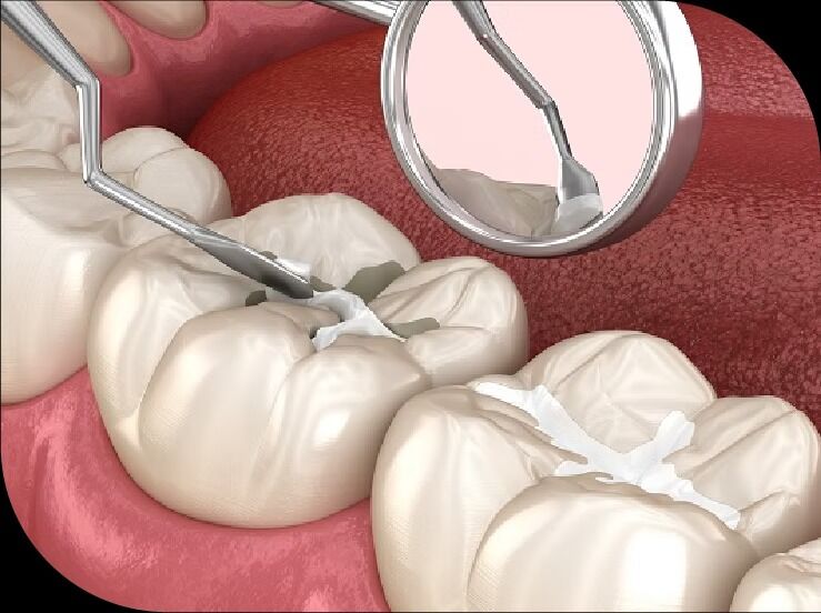 Toronto, Dental, Mh2 Dental - Queen West