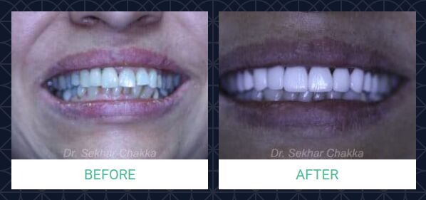 New York, Dental, Dentist In Rancho Cucamonga