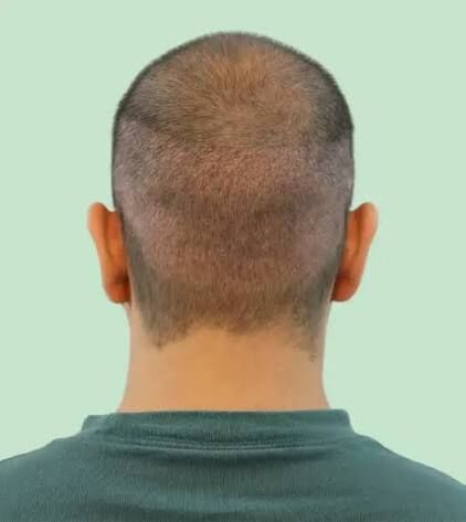 New Delhi, Health, Activate Your Hair