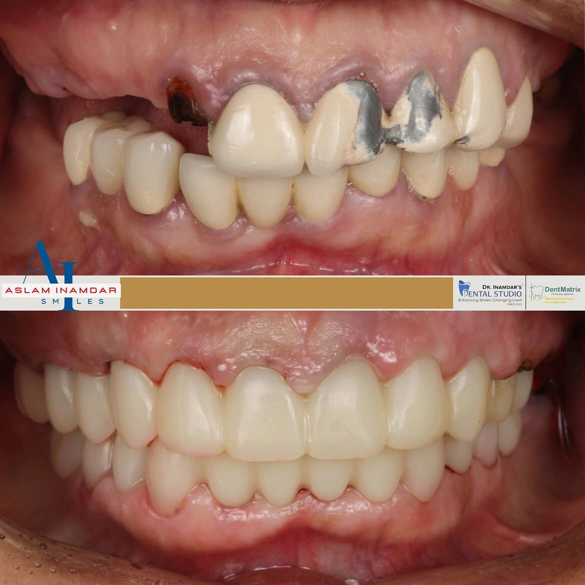 Dubai, Dental, Trust First, Treatment Second - Best Dental Clinic In Mumbai