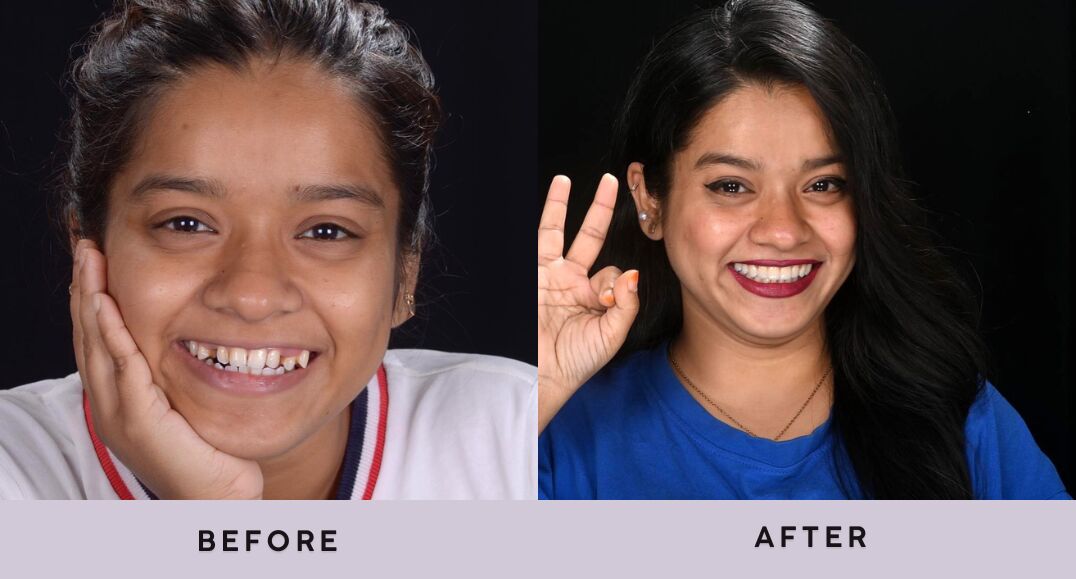 Dubai, Dental, Trust First, Treatment Second - Best Dental Clinic In Mumbai