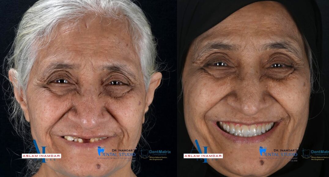 Dubai, Dental, Trust First, Treatment Second - Best Dental Clinic In Mumbai