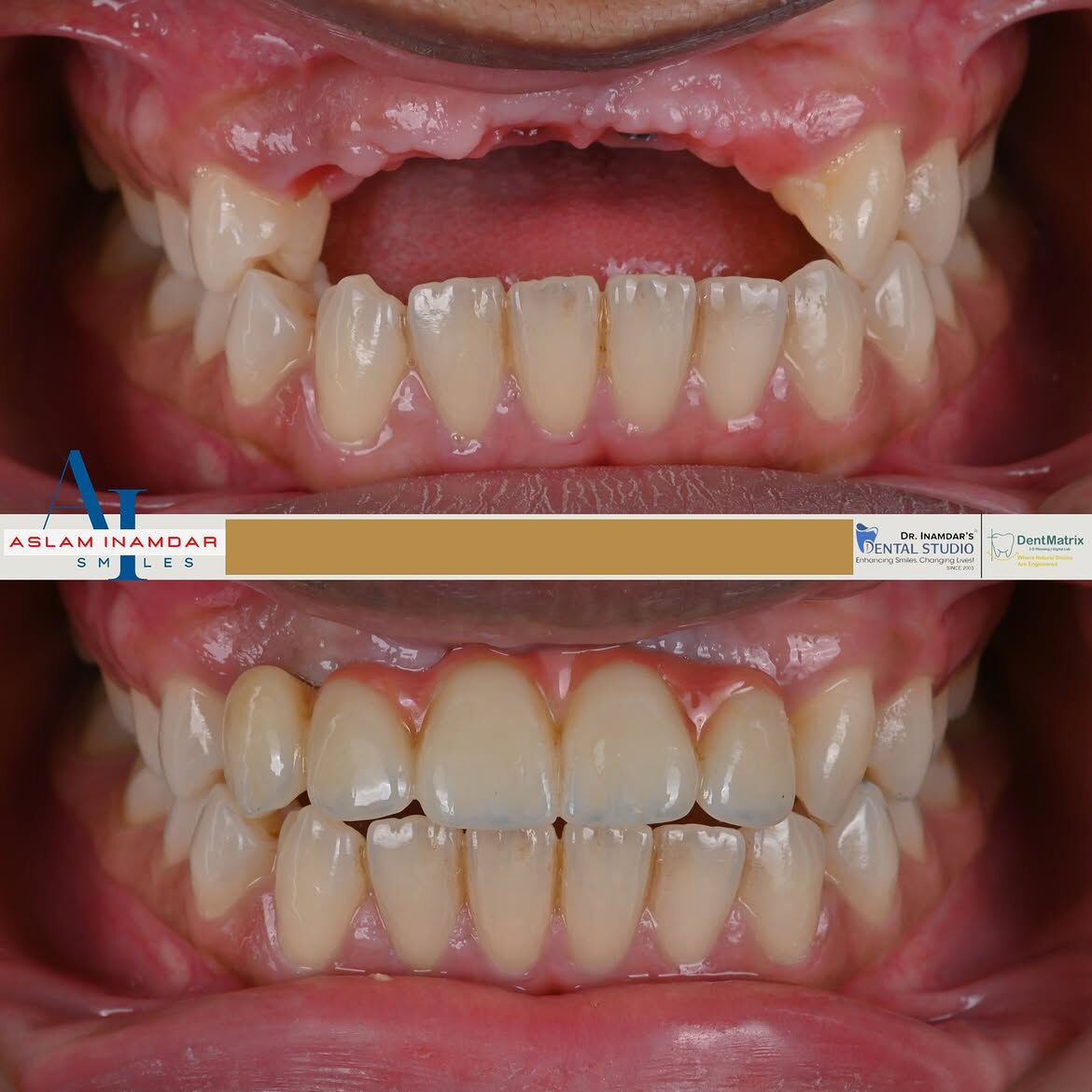 Dubai, Dental, Trust First, Treatment Second - Best Dental Clinic In Mumbai
