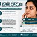 INR 3000,  Under Eye Dark Circle Treatment In Kukatpally | Look Refreshed