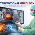Interventional Oncologist In Delhi | Dr. Akash Bansal