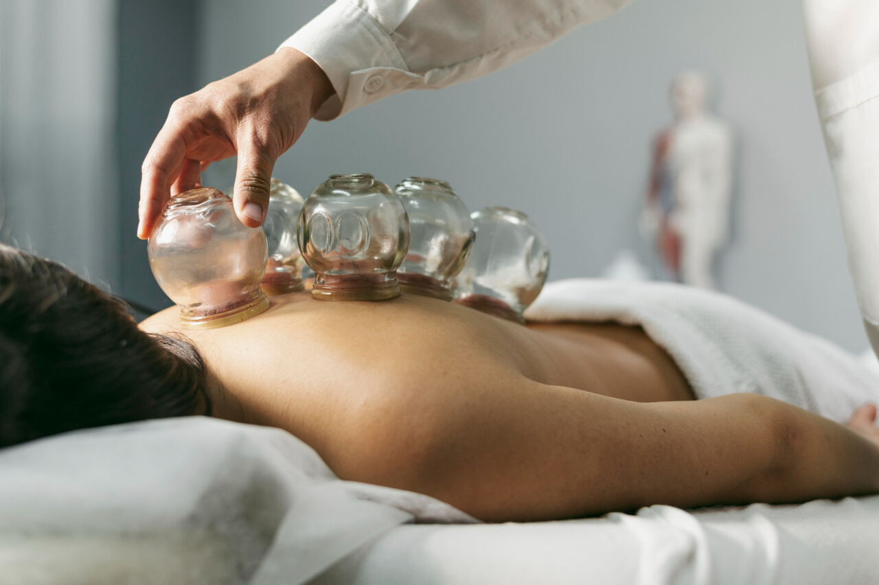 London, Health, Discover Professional Cupping Therapy In London For Relaxation And Wellness