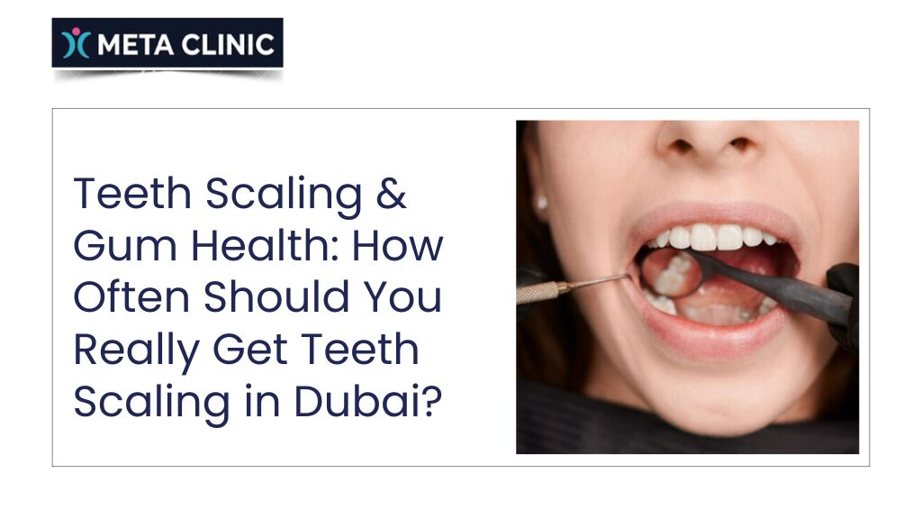 Al Nahda, Dental, Teeth Scaling & Gum Health: How Often Should You Really Get Teeth Scaling In Dubai? META