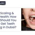 Teeth Scaling & Gum Health: How Often Should You Really Get Teeth Scaling In Dubai? META