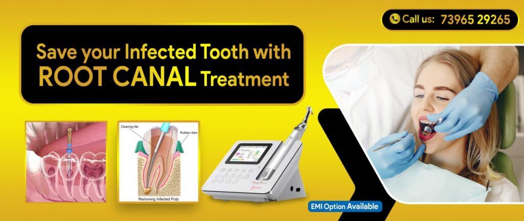 Hyderabad, Dental, Toothache Won
