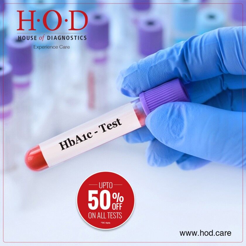 New Delhi, Health & Beauty Items, INR 299,  HbA1c Screening For Diabetes And Prediabetes
