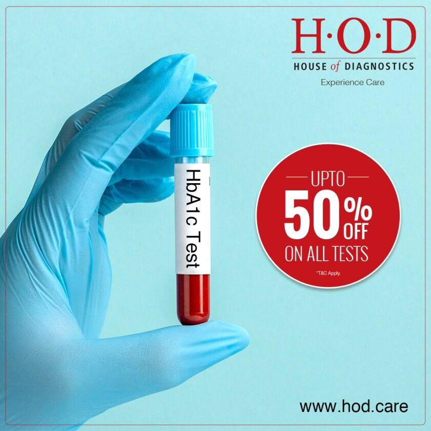 New Delhi, Health & Beauty Items, INR 299,  HbA1c Screening For Diabetes And Prediabetes