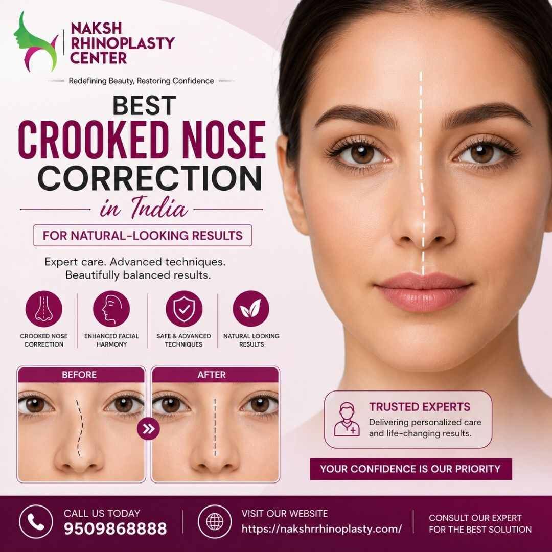 Jaipur, Health, Best Crooked Nose Correction In India For Natural-Looking Results