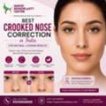 Best Crooked Nose Correction In India For Natural-Looking Results