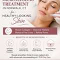 Microneedling Treatment In Norwalk, CT For Healthy-Looking Skin