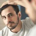 Hair Transplant Cost In Delhi &ndash; Get Expert Guidance Today