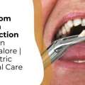 Wisdom Tooth Extraction Cost Bangalore &mdash; What You Should Know