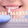 Top Guide About Tooth Coloured Fillings From Nearby Dental Clinic In Ormeau City