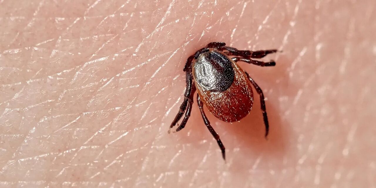 New York, Health, Natural Approaches For Lyme Disease Wellness And Care