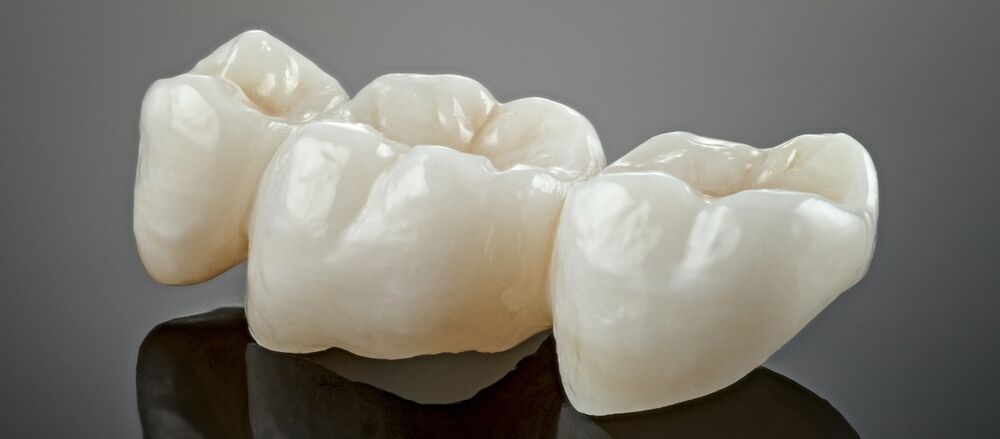 Miami, Dental, Same-Day Crowns Miami For Fast, Precise Smile Restoration Today