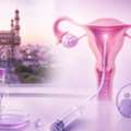 IUI Clinic, Hospital & IUI Treatment In Hyderabad | IUI Doctors In Hyderabad