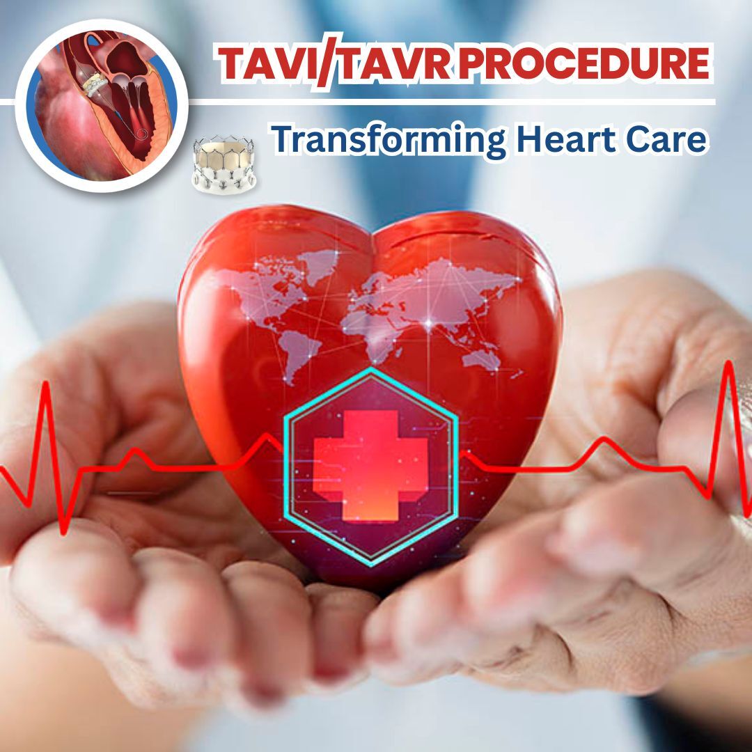 Kabul, Health, TAVR And TAVI Surgery In India