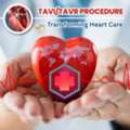 TAVR And TAVI Surgery In India