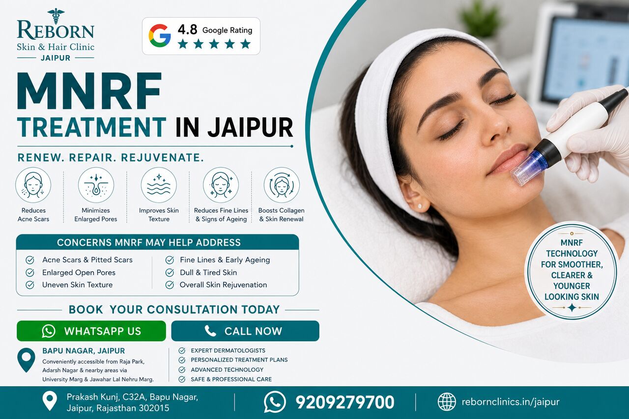 Jaipur, Health & Beauty Items, INR 4500,  MNRF Treatment In Jaipur For Acne Scars