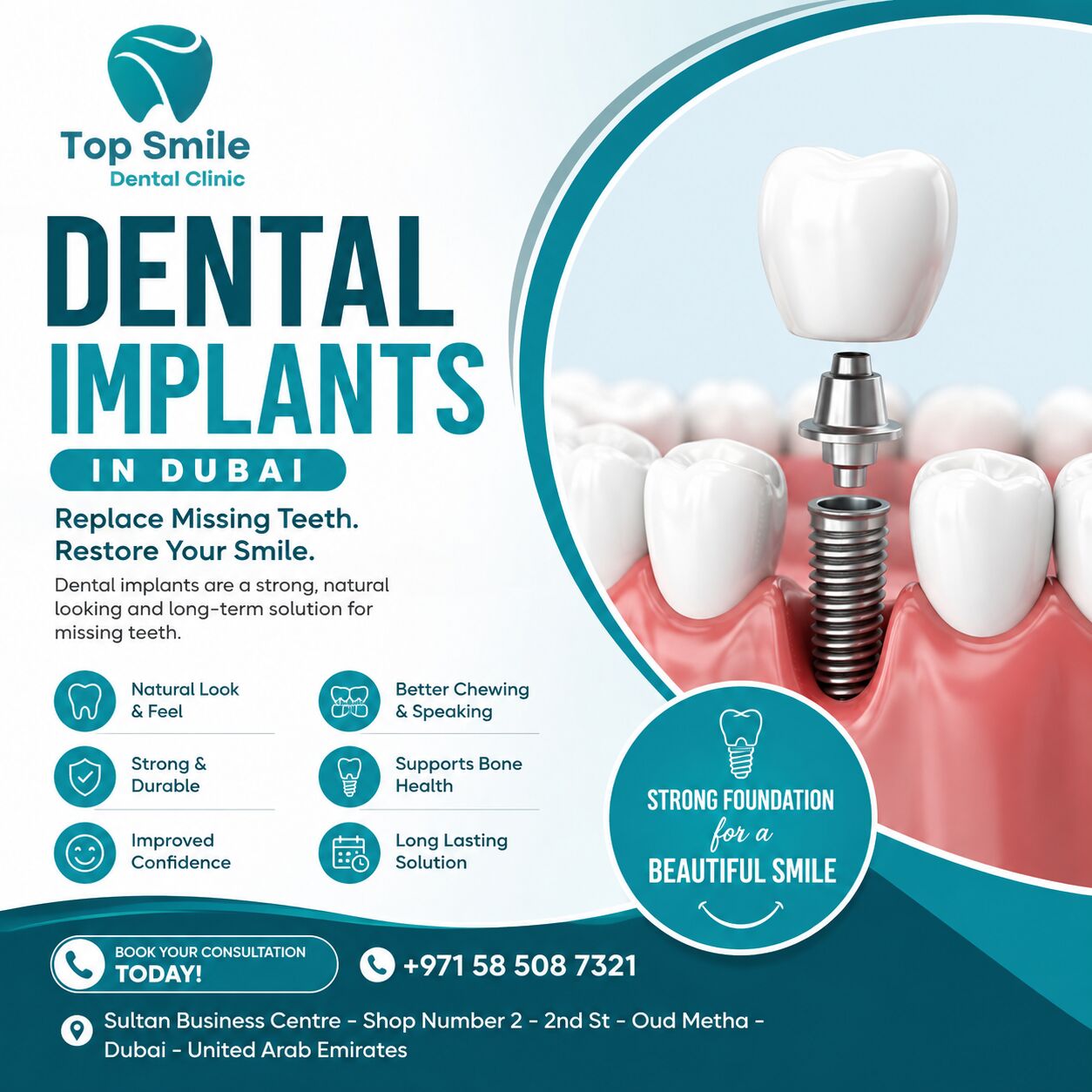 Dubai, Dental, Dental Implants In Dubai &ndash; Restore Your Smile With Confidence