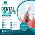 Dental Implants In Dubai &ndash; Restore Your Smile With Confidence