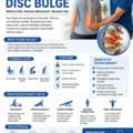 Physiotherapy For Bulging Disc