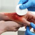 Wound Dressing Clinic In Ajman