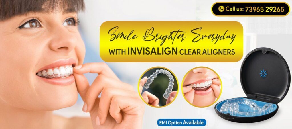 Hyderabad, Dental, Straighten Your Smile Without Anyone Noticing! Invisalign In AS Rao Nagar