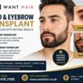 Beard & Eyebrow Transplant - Define Your Look With Natural Results