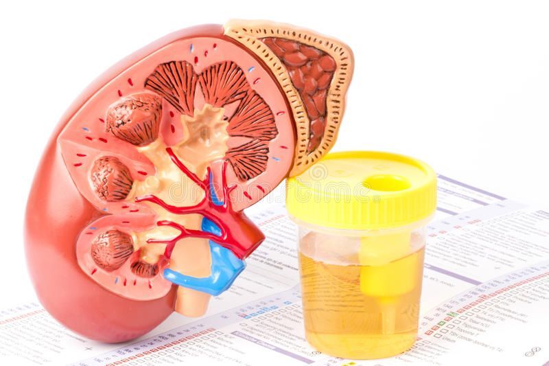 New Delhi, Health, Protein In Urine Treatment In Delhi
