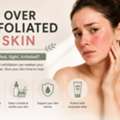 Over Exfoliated Skin