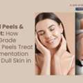 Chemical Peels & Skin Reset: How Medical-Grade Chemical Peels Treat Hyperpigmentation & Re