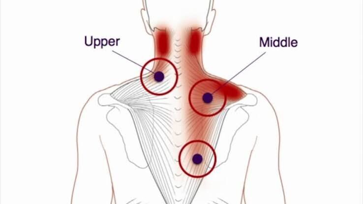 Gurgaon, Businesses For Sale, Trigger Point Pain Treatment For Muscle Tension Gurgaon
