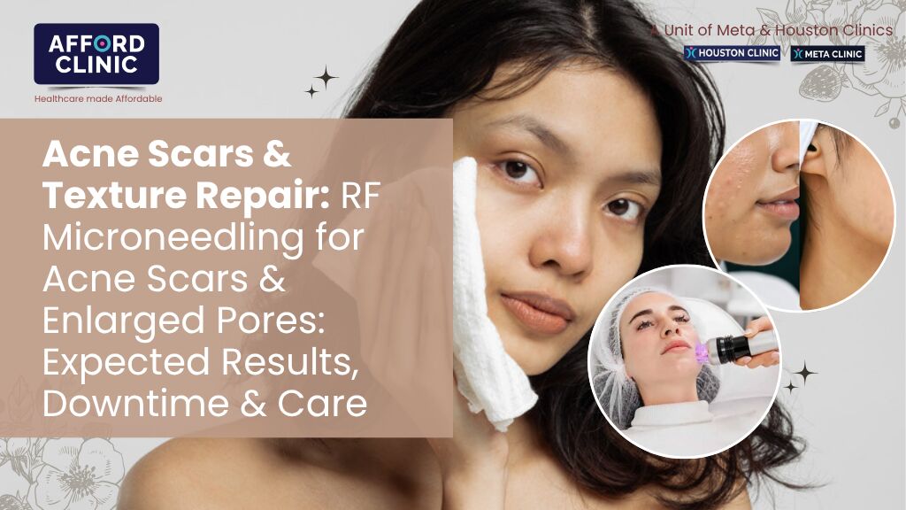 Al Nahda, Health, Microneedling For Acne Scars & Enlarged Pores: AFFORD Clinic In Al Nahda Dubai