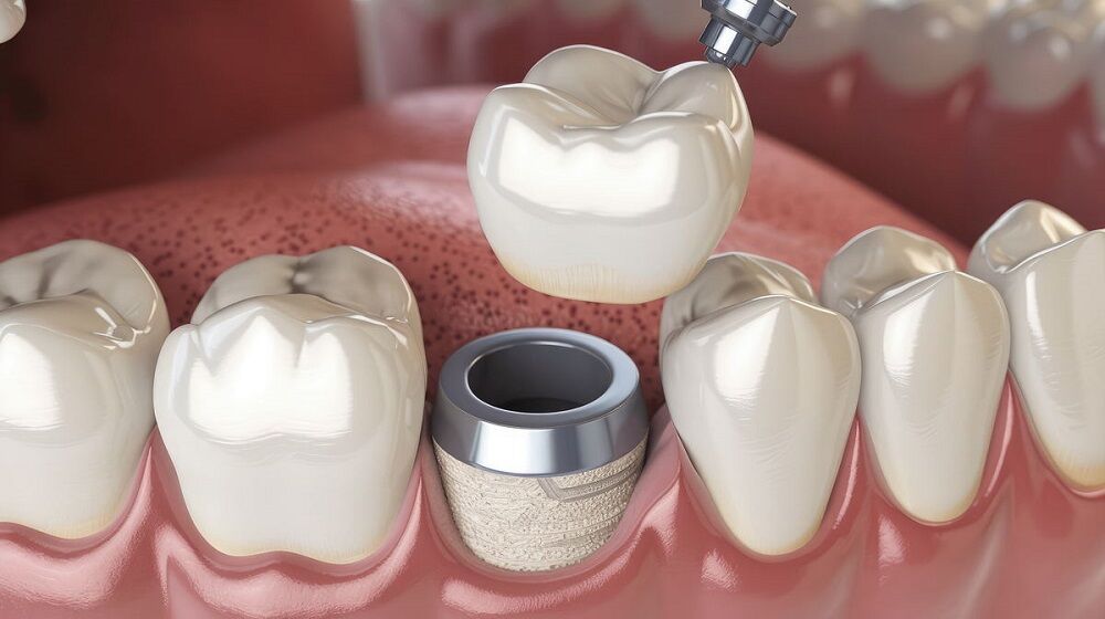 Toronto, Dental, Kids & Family Dental