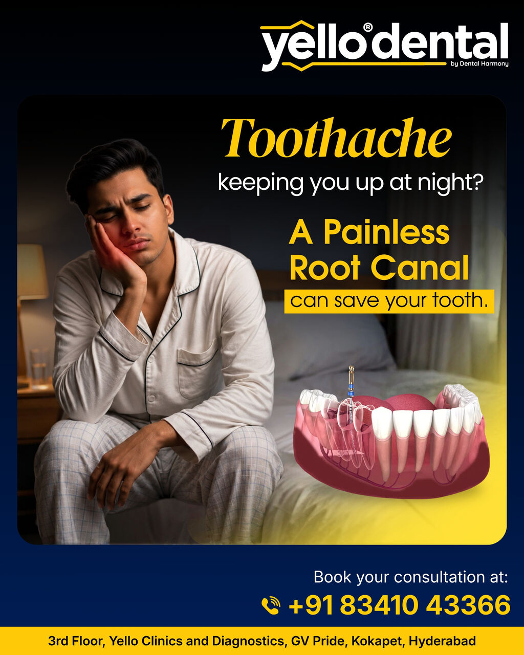 Hyderabad, Dental, Dental Implants In Kokapet