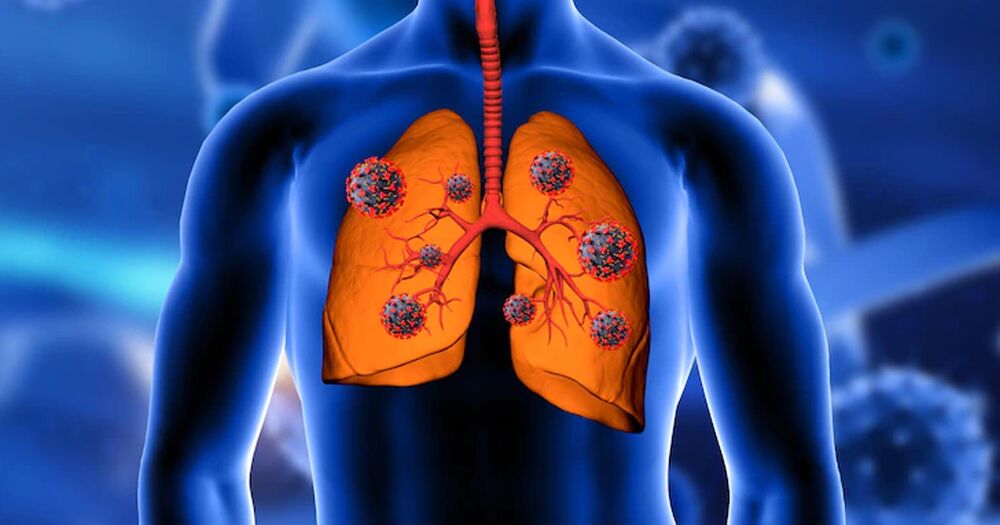 Lucknow, Guest Posting, Best Gastroenterologist & Pulmonologist In Lucknow For Complete Digestive And Respiratory