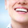 Best Teeth Whitening Clinic In Delhi NCR
