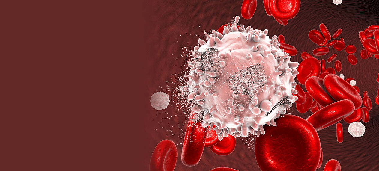 Ghaziabad, Health, Advanced Leukemia Cancer Care In Noida | Dr. Manish Singhal