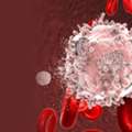 Advanced Leukemia Cancer Care In Noida | Dr. Manish Singhal