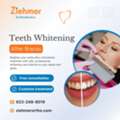Teeth Whitening After Braces In Scottsdale
